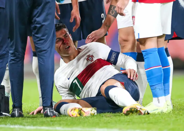 Portugal : Nez cassé pour Ronaldo !