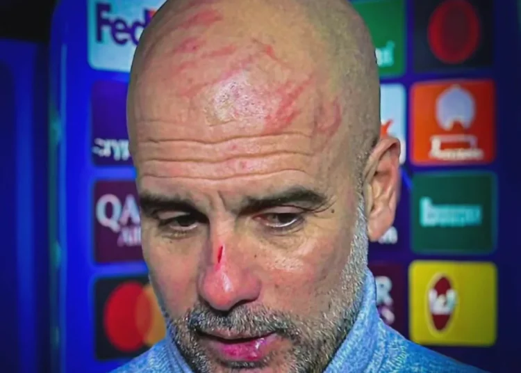 Guardiola : « Je voulais me faire du mal » après ses blessures au visage !