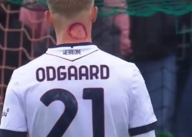 Bologne : L’intrigante « attaque de zombie » sur le cou de Jens Odgaard choque les fans !