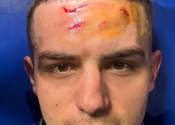 Le front en sang après Dortmund, Krstovic affiche ses “stigmates” et fait passer un message fort