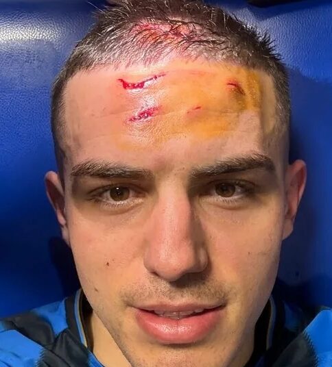 Le front en sang après Dortmund, Krstovic affiche ses “stigmates” et fait passer un message fort